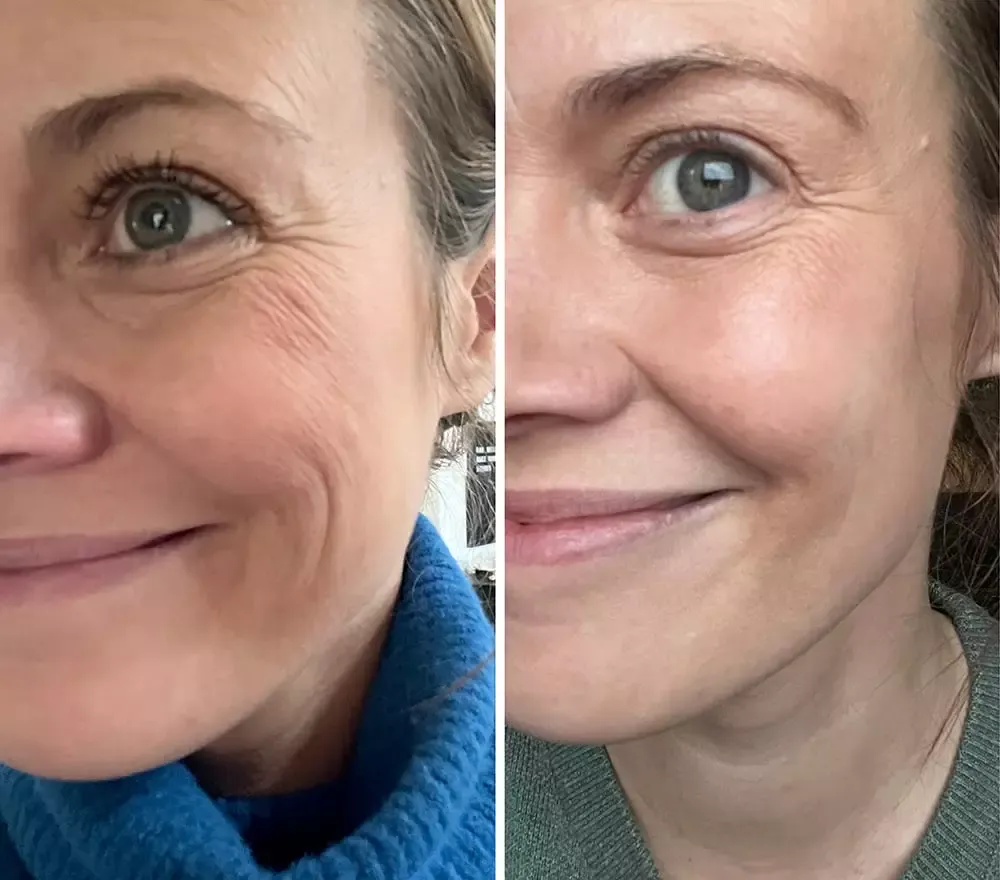 Balenie kolagénu Oslo Skin Lab THE SOLUTION z môjho testu